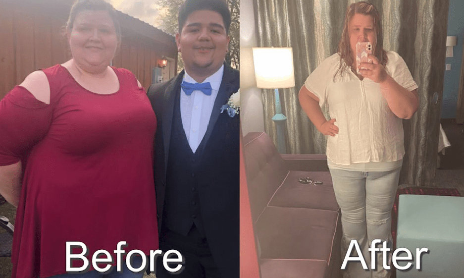 Before and After