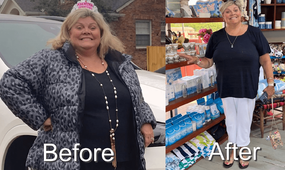 Before and After